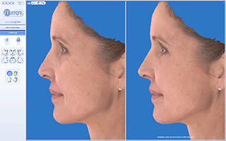 Vectra 3D Computer Imaging Naples