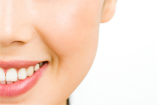 Cheek Implants Naples