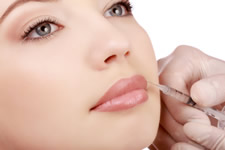 Collagen Injections Naples