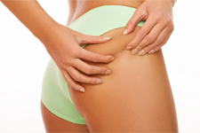 Liposuction Naples