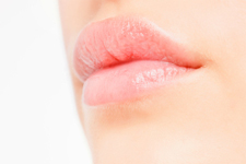 Lip Augmentation Naples