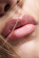 Lip Augmentation Naples