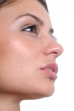 Nose Surgery | Rhinoplasty | Naples