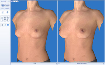 Vectra 3D Computer Imaging Naples