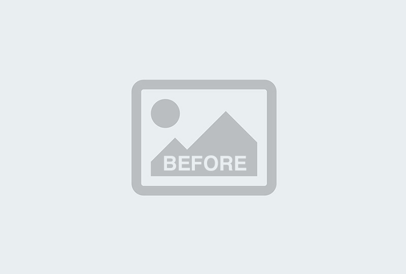 Before Image: Facelift – CASE 19 - front