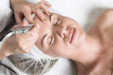 Laser Skin Resurfacing Naples