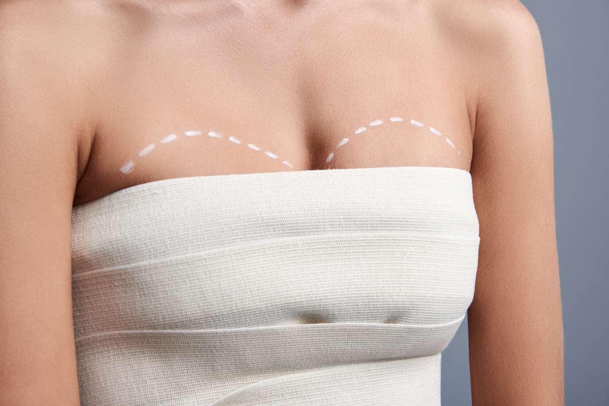 Breast augmentation. Close up of young woman wearing white bandages on her body and having lines before the breast augmentation