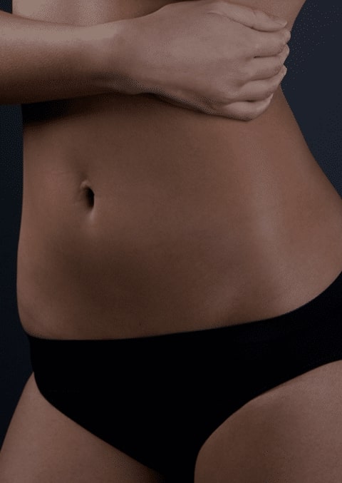 body plastic surgery services naples fl